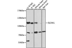 Western blot analysis of extracts of various cell lines, using SLC4 antibody (7391) at 1:1000 dilution. (Band 3/AE1 抗体  (AA 1-353))