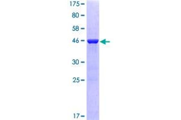 GTPase NRas Protein (NRAS) (AA 1-189) (GST tag)