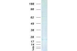 Western Blotting (WB) image for Dual Specificity Phosphatase 23 (DUSP23) protein (Myc-DYKDDDDK Tag) (ABIN2719834)