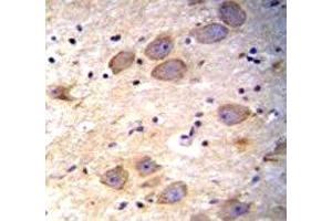 cIAP2 antibody immunohistochemistry analysis in formalin fixed and paraffin embedded human brain tissue. (BIRC3 抗体  (AA 101-131))