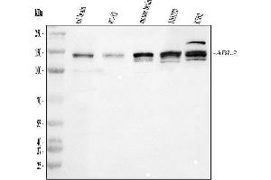 Western blot analysis of ABL2 using anti-ABL2 antibody (ABIN4886412). (ABL2 抗体  (AA 1065-1182))
