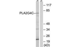 Western Blotting (WB) image for anti-Phospholipase A2, Group IVC (Cytosolic, Calcium-Independent) (PLA2G4C) (AA 301-350) antibody (ABIN2890254) (PLA2G4C 抗体  (AA 301-350))