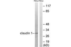 Western blot analysis of extracts from HeLa cells, treated with Hu 2nM 24h, using Claudin 1 (Ab-210) Antibody. (Claudin 1 抗体  (AA 162-211))
