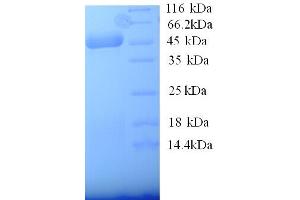 SDS-PAGE (SDS) image for Hepatitis A Virus Cellular Receptor 1 (HAVCR1) (AA 17-397) protein (His tag) (ABIN5713192)