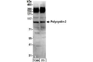 Western Blotting (WB) image for anti-Polycystic Kidney Disease 2 (Autosomal Dominant) (PKD2) (AA 918-968) antibody (ABIN7451972) (PKD2 抗体  (AA 918-968))