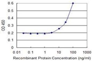 Detection limit for recombinant GST tagged FBXO27 is 3 ng/ml as a capture antibody. (FBXO27 抗体  (AA 192-283))