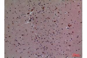 Immunohistochemistry (IHC) analysis of paraffin-embedded Mouse Brain, antibody was diluted at 1:100. (Cullin 4B 抗体  (Internal Region))