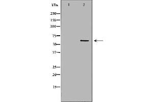 Western blot analysis of Hela whole cell lysates, using PPP3CA  Antibody.