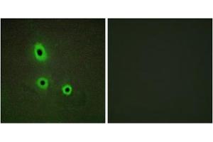 Immunofluorescence analysis of A549 cells, using EFNA5 antibody. (Ephrin A5 抗体  (Internal Region))