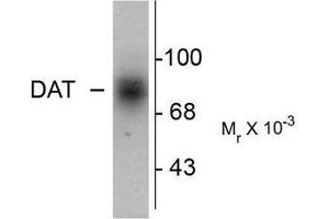Image no. 1 for anti-Solute Carrier Family 6 (Neurotransmitter Transporter, Dopamine), Member 3 (SLC6A3) (C-Term) antibody (ABIN372613) (SLC6A3 抗体  (C-Term))