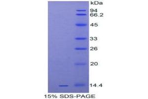 SDS-PAGE of Protein Standard from the Kit (Highly purified E. (IL-33 CLIA Kit)