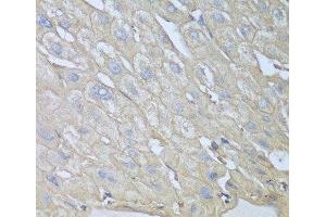 Immunohistochemistry of paraffin-embedded Human liver using RPH3AL Polyclonal Antibody at dilution of 1:100 (40x lens). (RPH3AL 抗体)