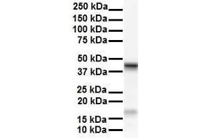 WB Suggested Anti-SMYD5 antibody Titration: 1 ug/mL Sample Type: Human HepG2 (SMYD5 抗体  (C-Term))