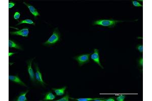 Immunofluorescence of purified MaxPab antibody to PDIA3 on HeLa cell. (PDIA3 抗体  (AA 1-505))