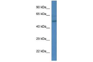 WB Suggested Anti-Esrra Antibody   Titration: 1. (ESRRA 抗体  (C-Term))