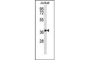 Western blot analysis of HSPBP1 Antibody (N-term) in Jurkat cell line lysates (35ug/lane). (HSPBP1 抗体  (N-Term))
