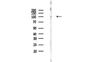 Western blot analysis of lysates from Rat lung, using C Antibody at 1/1000 dilution.