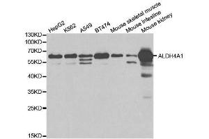 Western blot analysis of extracts of various cell lines, using ALDH4A1 antibody. (ALDH4A1 抗体  (AA 354-563))