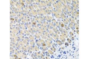 Immunohistochemistry of paraffin-embedded Mouse stomach using GLS Polyclonal Antibody at dilution of 1:100 (40x lens). (Glutaminase 抗体)