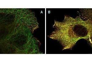 Immunofluorescence (IF) image for anti-V-Akt Murine Thymoma Viral Oncogene Homolog 1 (AKT1) (pSer473) antibody (ABIN964561)