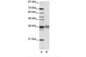 Image no. 2 for anti-T-Cell Leukemia Homeobox 2 (TLX2) (C-Term) antibody (ABIN202158) (TLX2 抗体  (C-Term))