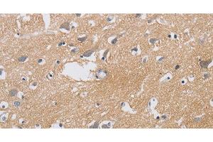 Immunohistochemistry of paraffin-embedded Human brain using KCNMB3 Polyclonal Antibody at dilution of 1:40 (KCNMB3 抗体)