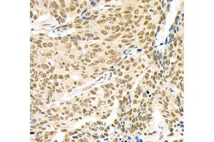 Immunohistochemistry (Paraffin-embedded Sections) (IHC (p)) image for anti-serine/threonine Kinase 4 (STK4) antibody (ABIN7075561)
