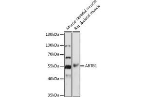 Western blot analysis of extracts of various cell lines, using  antibody  at 1:1000 dilution. (ABTB1 抗体)
