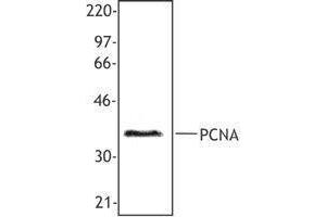 Western Blotting (WB) image for anti-Proliferating Cell Nuclear Antigen (PCNA) antibody (ABIN2665321)