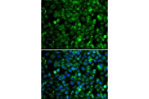 Immunofluorescence analysis of MCF7 cell using TMLHE antibody. (TMLHE 抗体)