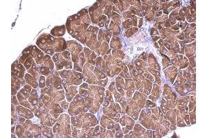 IHC-P Image RPS15 antibody detects RPS15 protein at cytosol on mouse prostate by immunohistochemical analysis. (RPS15 抗体)