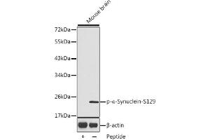 Western blot analysis of extracts from mouse brain tissue, using Phospho-α-Synuclein-S129 antibody (ABIN3020489, ABIN3020490, ABIN3020491 and ABIN1682058). (SNCA 抗体  (pSer129))