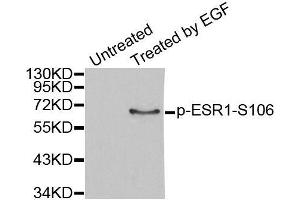 Western blot analysis of extracts from MCF7 cells, using Phospho-ESR1-S106 antibody (ABIN2988004). (Estrogen Receptor alpha 抗体  (pSer106))