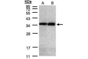 WB Image Sample(30 μg of whole cell lysate) A:HeLa S3, B:Hep G2, 12% SDS PAGE antibody diluted at 1:2000 (Annexin V 抗体)