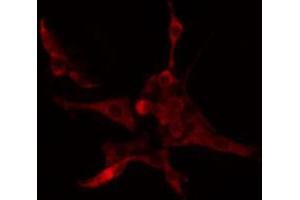 ABIN6274659 staining COLO205 cells by IF/ICC. (CYP4B1 抗体  (Internal Region))