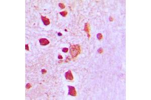 Immunohistochemistry (IHC) image for anti-Peroxiredoxin 3 (PRDX3) (Center) antibody (ABIN7297856)
