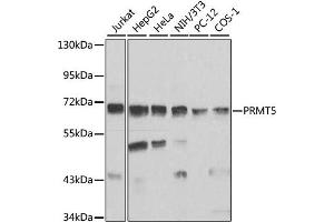 Western blot analysis of extracts of various cell lines, using PRMT5 antibody (ABIN1874327) at 1:1000 dilution. (PRMT5 抗体)