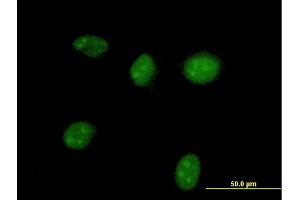 Immunofluorescence of purified MaxPab antibody to HGD on HeLa cell. (HGD 抗体  (AA 1-445))