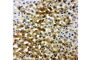 Anti-Bone Sialoprotein antibody, IHC(P) IHC(P): Rat Liver Tissue (IBSP 抗体  (C-Term))