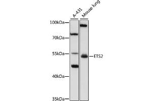 Western blot analysis of extracts of various cell lines, using SPRY3 antibody (ABIN6133259, ABIN6140325, ABIN6140326 and ABIN6223170) at 1:1000 dilution. (ETS2 抗体  (AA 160-350))