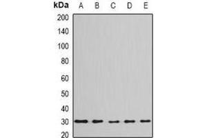 Western blot analysis of BPGM expression in Jurkat (A), Hela (B), mouse liver (C), mouse testis (D), rat brain (E) whole cell lysates. (BPGM 抗体)