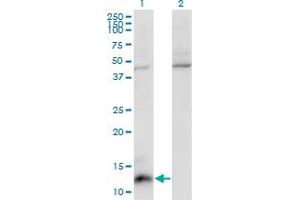 Western Blot analysis of CCL7 expression in transfected 293T cell line by CCL7 monoclonal antibody (M03), clone 4B5. (CCL7 抗体  (AA 24-99))