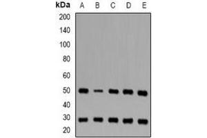 Western blot analysis of CD16b expression in Jurkat (A), THP1 (B), mouse liver (C), mouse thymus (D), rat spleen (E) whole cell lysates. (FCGR3B 抗体)