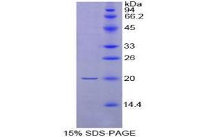 SDS-PAGE analysis of Rat Neurotensin Protein. (Neurotensin Protein (NTS))