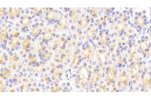 Immunohistochemistry (IHC) image for anti-Von Willebrand Factor A Domain Containing 1 (VWA1) (AA 43-285) antibody (ABIN7440287)