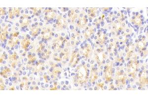 Detection of vWA1 in Rat Stomach Tissue using Polyclonal Antibody to Von Willebrand Factor A Domain Containing Protein 1 (vWA1) (VWA1 抗体  (AA 43-285))