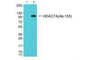 Western blot analysis of extracts from JK cells (Lane 2), using HDAC7A (Ab-155) antiobdy. (HDAC7 抗体  (Ser155))