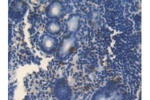 Detection of BMP4 in Human Stomach Tissue using Polyclonal Antibody to Bone Morphogenetic Protein 4 (BMP4) (BMP4 抗体  (AA 22-408))