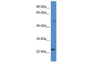 Western Blotting (WB) image for anti-Cytochrome P450, Family 1, Subfamily B, Polypeptide 1 (CYP1B1) (Middle Region) antibody (ABIN2784612)