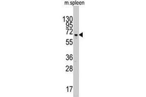 Western blot analysis of Parp3 polyclonal antibody  in mouse spleen tissue lysate (35 ug/lane). (PARP3 抗体  (C-Term))